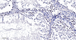 SUV39H2 Antibody in Immunohistochemistry (Paraffin) (IHC (P))
