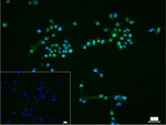 JMJD2B Recombinant Rabbit Monoclonal Antibody (G8C10)