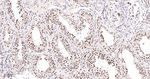 JMJD2B Antibody in Immunohistochemistry (Paraffin) (IHC (P))