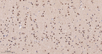 JMJD2B Antibody in Immunohistochemistry (Paraffin) (IHC (P))