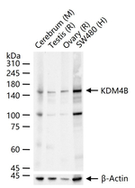 JMJD2B Antibody in Western Blot (WB)