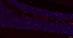 GSTP1 Antibody in Immunohistochemistry (Paraffin) (IHC (P))