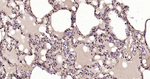 GSTP1 Antibody in Immunohistochemistry (Paraffin) (IHC (P))