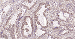 GSTP1 Antibody in Immunohistochemistry (Paraffin) (IHC (P))