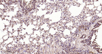 GSTP1 Antibody in Immunohistochemistry (Paraffin) (IHC (P))