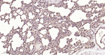GSTP1 Antibody in Immunohistochemistry (Paraffin) (IHC (P))