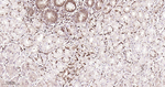 GSTP1 Antibody in Immunohistochemistry (Paraffin) (IHC (P))