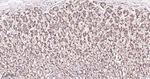 GSTP1 Antibody in Immunohistochemistry (Paraffin) (IHC (P))