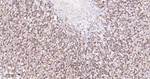 GSTP1 Antibody in Immunohistochemistry (Paraffin) (IHC (P))