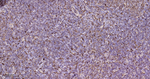 GSTP1 Antibody in Immunohistochemistry (Paraffin) (IHC (P))