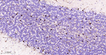 GSTP1 Antibody in Immunohistochemistry (Paraffin) (IHC (P))