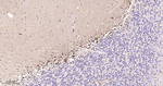 GSTP1 Antibody in Immunohistochemistry (Paraffin) (IHC (P))