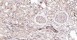 GSTP1 Antibody in Immunohistochemistry (Paraffin) (IHC (P))