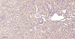 GSTP1 Antibody in Immunohistochemistry (Paraffin) (IHC (P))