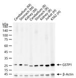 GSTP1 Antibody in Western Blot (WB)