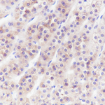 INHA Recombinant Rabbit Monoclonal Antibody (A8H6)