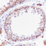 INHA Antibody in Immunohistochemistry (Paraffin) (IHC (P))