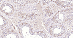 INHA Antibody in Immunohistochemistry (Paraffin) (IHC (P))