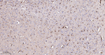 Paxillin Antibody in Immunohistochemistry (Paraffin) (IHC (P))