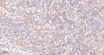 Paxillin Antibody in Immunohistochemistry (Paraffin) (IHC (P))