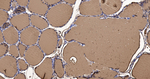Thyroglobulin Antibody in Immunohistochemistry (Paraffin) (IHC (P))