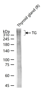 Thyroglobulin Antibody in Western Blot (WB)