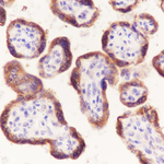 Laminin beta-1 Antibody in Immunohistochemistry (Paraffin) (IHC (P))