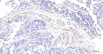 CD59 Recombinant Rabbit Monoclonal Antibody (E10F7)