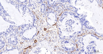CD59 Antibody in Immunohistochemistry (Paraffin) (IHC (P))