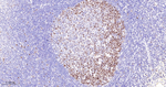 MCM3 Antibody in Immunohistochemistry (Paraffin) (IHC (P))