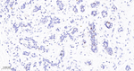 MCM3 Antibody in Immunohistochemistry (Paraffin) (IHC (P))