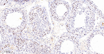 MCM3 Antibody in Immunohistochemistry (Paraffin) (IHC (P))
