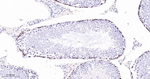 MCM3 Antibody in Immunohistochemistry (Paraffin) (IHC (P))