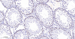 MCM3 Antibody in Immunohistochemistry (Paraffin) (IHC (P))