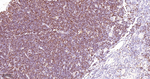 MCM3 Antibody in Immunohistochemistry (Paraffin) (IHC (P))