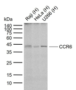 CCR6 Recombinant Rabbit Monoclonal Antibody (H8B8)