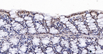 CDK8 Antibody in Immunohistochemistry (Paraffin) (IHC (P))