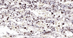 CDK8 Antibody in Immunohistochemistry (Paraffin) (IHC (P))