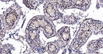 CDK8 Antibody in Immunohistochemistry (Paraffin) (IHC (P))