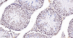 CDK8 Antibody in Immunohistochemistry (Paraffin) (IHC (P))