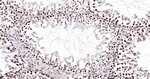CDK8 Antibody in Immunohistochemistry (Paraffin) (IHC (P))