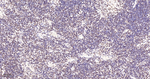CDK8 Antibody in Immunohistochemistry (Paraffin) (IHC (P))