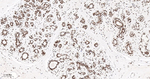 CDK8 Antibody in Immunohistochemistry (Paraffin) (IHC (P))