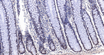 CDK8 Antibody in Immunohistochemistry (Paraffin) (IHC (P))