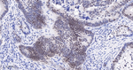 CDK8 Antibody in Immunohistochemistry (Paraffin) (IHC (P))