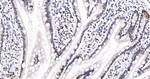 CDK8 Antibody in Immunohistochemistry (Paraffin) (IHC (P))