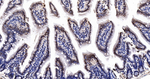 CDK8 Recombinant Rabbit Monoclonal Antibody (B7D5)