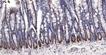 CDK8 Antibody in Immunohistochemistry (Paraffin) (IHC (P))