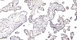 CDK8 Antibody in Immunohistochemistry (Paraffin) (IHC (P))