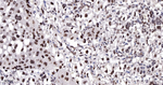 CDK8 Antibody in Immunohistochemistry (Paraffin) (IHC (P))